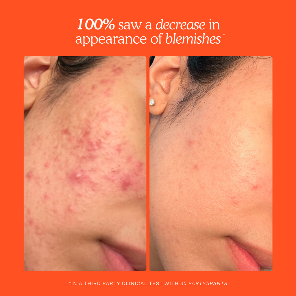 SOS Daily Rescue Facial Spray — Tower 28 Beauty