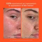 SOS Daily Rescue Facial Spray — Tower 28 Beauty